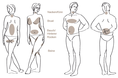 Mögliche Stellen für eine Fettabsaugung 