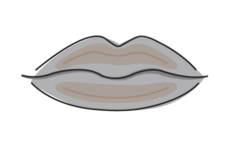 Volumenaufbau bei einer Lippenvergrößerung mit Hyaluron 