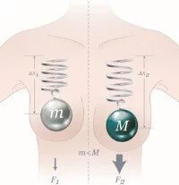 B-Lite Implantat Brustvergrößerung Nürnberger Klinik Dr. Baetge
