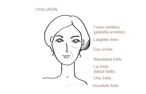 grafik_faltenbehandlung_hyaluron_EN.png