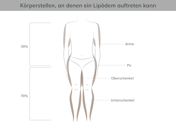 Körperstellen Lipödem